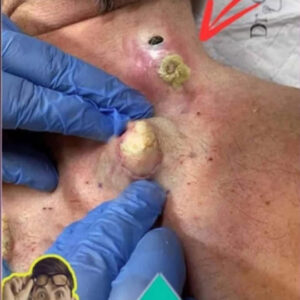 SEVEN THINGS THAT CLOG YOUR PORES AND CAUSE ACNE SEVEN THINGS THAT CLOG YOUR PORES AND CAUSE ACNE