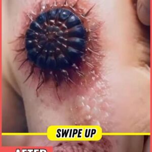 Please do not look at these 9 pictures If You Have A Body Acne Please do not look at these 9 pictures If You Have A Body Acne