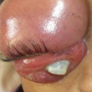 Body Acne: 4 Tips To Get Rid Of Them Body Acne: 4 Tips To Get Rid Of Them