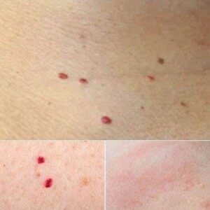 What Are Those Red Dots on Your Skin? Causes and When to Worry What Are Those Red Dots on Your Skin? Causes and When to Worry