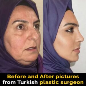 Plastic surgeon’s cosmetic work leaves people in disbelief Plastic surgeon’s cosmetic work leaves people in disbelief