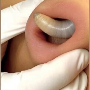SEVEN THINGS THAT CLOG YOUR PORES AND CAUSE ACNE SEVEN THINGS THAT CLOG YOUR PORES AND CAUSE ACNE
