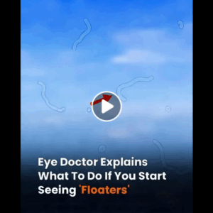 What Are Eye Floaters? Here What To Do If you Start Seeing Them What Are Eye Floaters? Here What To Do If you Start Seeing Them