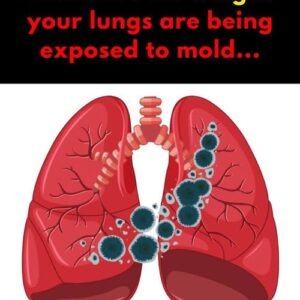 5 Signs Your Lungs are Being Exposed to Mold 5 Signs Your Lungs are Being Exposed to Mold