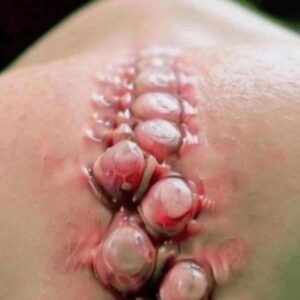 SEVEN THINGS THAT CLOG YOUR PORES AND CAUSE ACNE SEVEN THINGS THAT CLOG YOUR PORES AND CAUSE ACNE