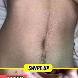 Body Acne: 4 Tips To Get Rid Of Them