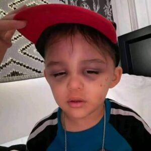A 3-year-old boy … A 3-year-old boy …