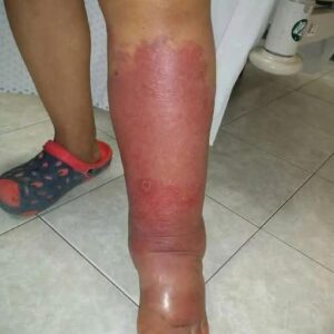 Signs on your FEET that indicate he is cr… see more Signs on your FEET that indicate he is cr… see more