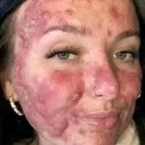 Her body was itchy, he thought it was an allergy Her body was itchy, he thought it was an allergy