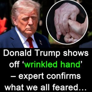Trump Displays Wrinkled Hands, Sparking Fresh Health Concerns Trump Displays Wrinkled Hands, Sparking Fresh Health Concerns