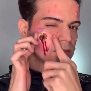 Please do not look at these 9 pictures If You Have A Body Acne