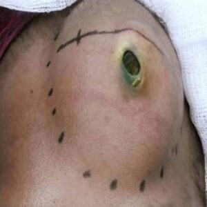 Please do not look at these 9 pictures If You Have A Body Acne