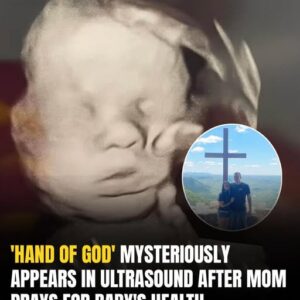 Mom spots ‘God’s hand’ cradling baby’s head in ultrasound Mom spots ‘God’s hand’ cradling baby’s head in ultrasound
