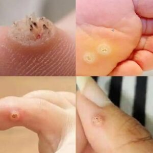 Be Very Careful: If You Notice This Skin Growth, It Could Be Serious Be Very Careful: If You Notice This Skin Growth, It Could Be Serious
