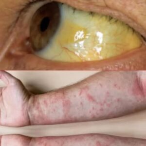 Your eyes say a lot about your health, symptoms warn of Your eyes say a lot about your health, symptoms warn of