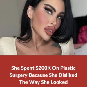 Plastic surgery enthusiast drops 0,000 to transform appearance Plastic surgery enthusiast drops 0,000 to transform appearance