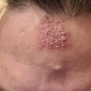 These are the consequences of sleeping with…See more These are the consequences of sleeping with…See more