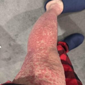 These are the consequences of sleeping with…See more These are the consequences of sleeping with…See more