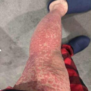 These are the consequences of sleeping with…See more These are the consequences of sleeping with…See more