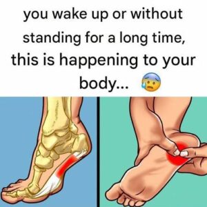 Recommended Exercises to Treat Plantar Fasciitis Recommended Exercises to Treat Plantar Fasciitis