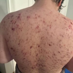 These are the consequences of sleeping with the…See more These are the consequences of sleeping with the…See more