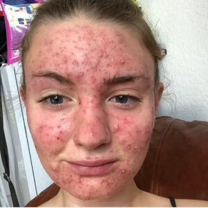 Her body was itching, I thought it was an allergy Her body was itching, I thought it was an allergy