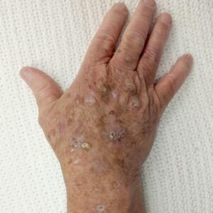 ATTENTION to these first signs of… ATTENTION to these first signs of…