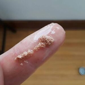 White bits in the egg: what are they really and should you be worried? White bits in the egg: what are they really and should you be worried?