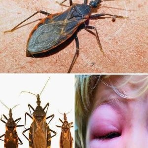 If you ever get stung, DON’T IGNORE the bite—it can be quite serious. Here’s what they are and what you should do If you ever get stung, DON’T IGNORE the bite—it can be quite serious. Here’s what they are and what you should do