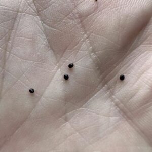 Don’t Ignore These Eggs in Your Yard