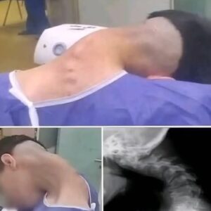 Young man hospitalized because he dropped his ca… See more Young man hospitalized because he dropped his ca… See more