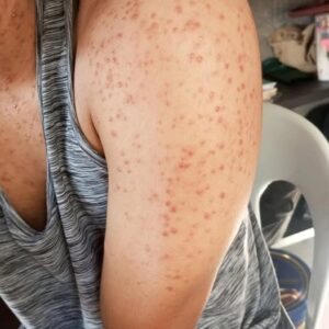 These are the consequences of sleeping with the…See more These are the consequences of sleeping with the…See more