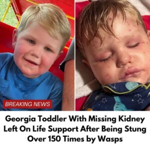 Georgia Toddler Hospitalized After Severe Yellow Jacket Attack Georgia Toddler Hospitalized After Severe Yellow Jacket Attack