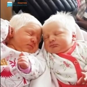 The First Ever Albino Twins Born In Argentina Will Leave You In Awe The First Ever Albino Twins Born In Argentina Will Leave You In Awe