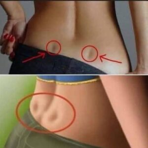 If you have these two holes in your back, it m If you have these two holes in your back, it m