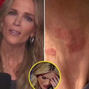 Megyn Kelly Hospitalized in Critical Condition… See more Megyn Kelly Hospitalized in Critical Condition… See more