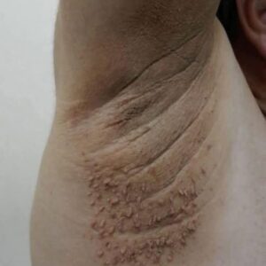 These are the first symptoms of cr…See more These are the first symptoms of cr…See more