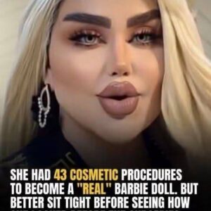 43 Surgeries to Look Like a Doll Spark Cont 43 Surgeries to Look Like a Doll Spark Cont