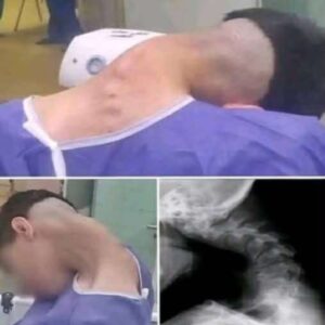 Young man hospitalized because he dropped his ca… See more Young man hospitalized because he dropped his ca… See more