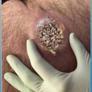 8 ALARMING SKIN SIGNS YOU CAN’T I 8 ALARMING SKIN SIGNS YOU CAN’T I