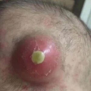 8 ALARMING SKIN SIGNS YOU CAN’T I 8 ALARMING SKIN SIGNS YOU CAN’T I