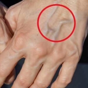 Why are your veins suddenly bulging and visible? Why are your veins suddenly bulging and visible?