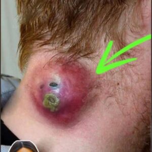Seven Things That Clog Your Pores Seven Things That Clog Your Pores