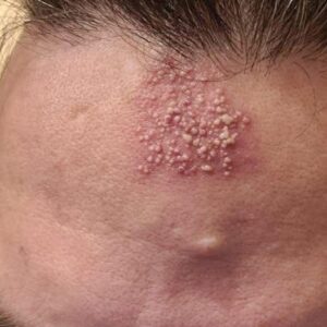 These are the consequences of sleeping with
