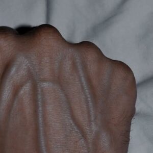 If your veins are visible in your hand, it is a signal of ca… See more