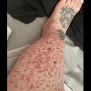 These are the consequences of sleeping with These are the consequences of sleeping with
