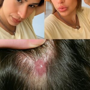 She is taken to the hospital and the diagnosis is revealed. She has…