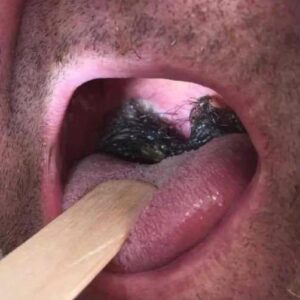 What No One Tells You About Intim What No One Tells You About Intim