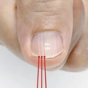 If you have these lines on your nails after 40, it is a clear sign that.. If you have these lines on your nails after 40, it is a clear sign that..