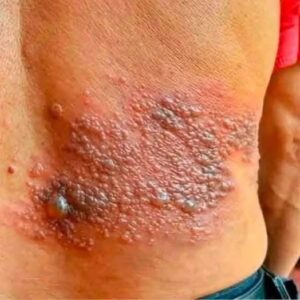 These are the consequences of sleeping with…See more These are the consequences of sleeping with…See more